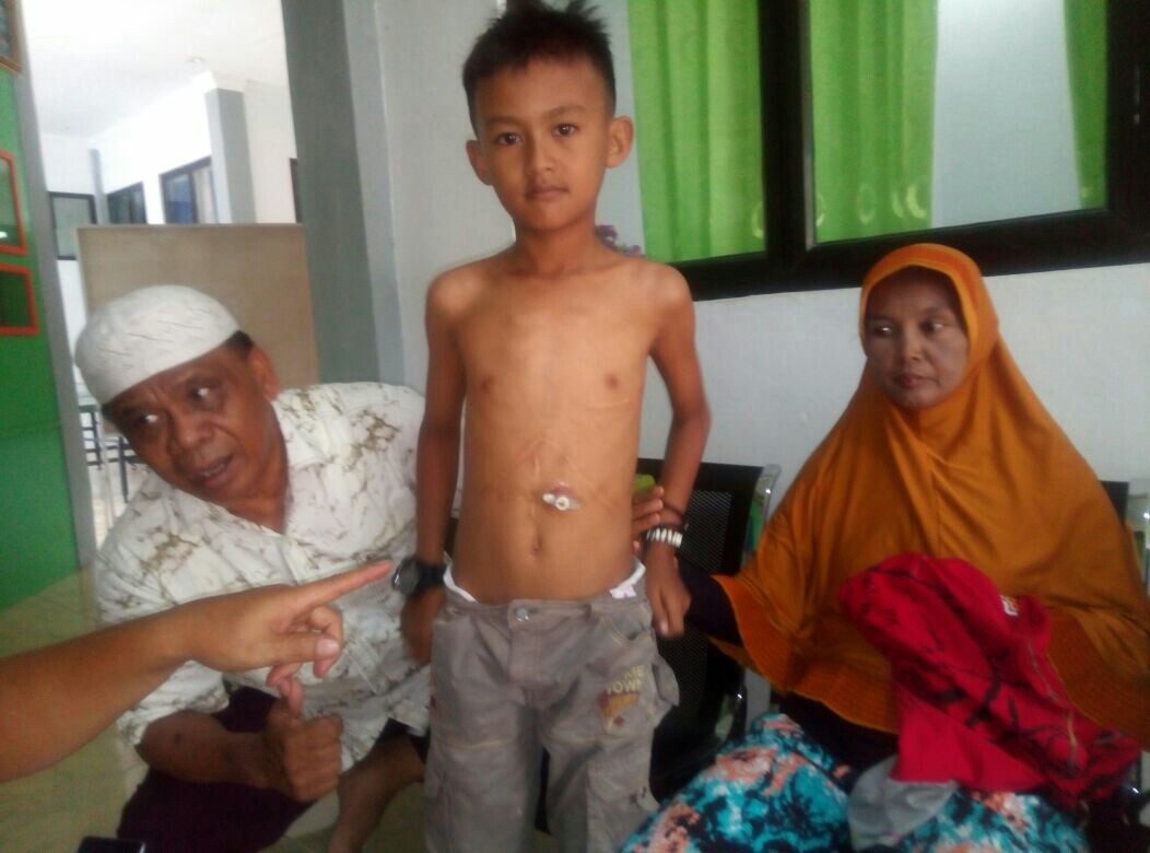 Arazaqul (12) murid kelas V SD 023 Tambusai Utara, butuh dana sekitar Rp1,5 miliar agar penyakit tumor yang dideritanya sejak usia 7 tahun bisa sembuh.